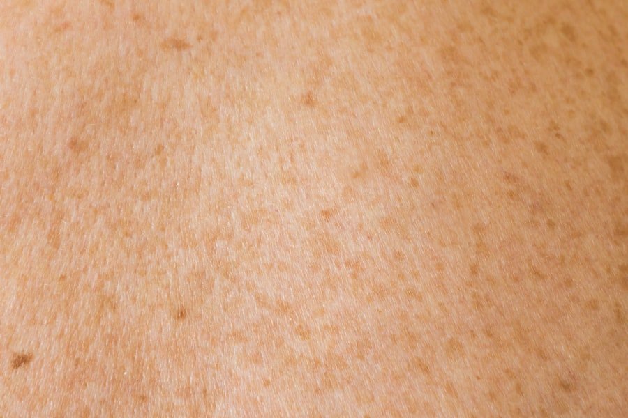 CBD skincare Australia