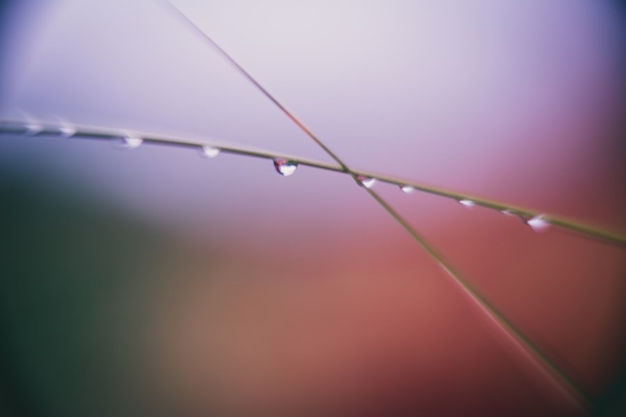 acupuncture points