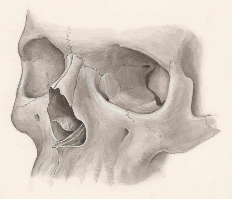 Photo nasal obstruction